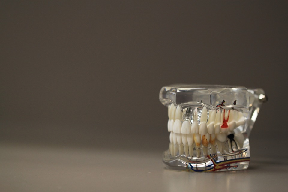 Dentistry Pixabay Public Domain